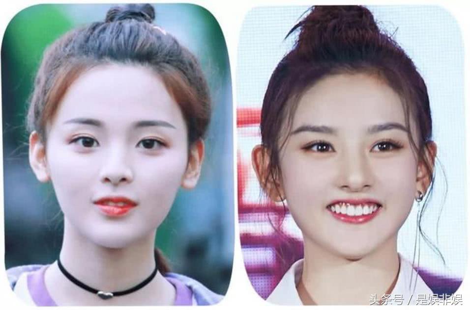 创造101紫宁戚薇对比,紫宁和戚薇照片对比
