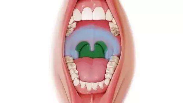 小孩发烧嘴里起泡有疹子,小孩发烧流感嘴巴起了好多溃疡