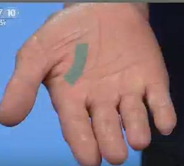 手上的健康秘密,手诊10种常见病从手上就能看出来