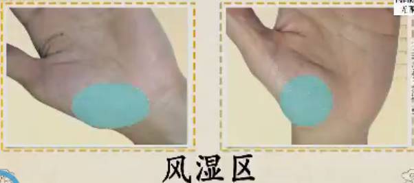 手是健康的镜子,手的健康识别