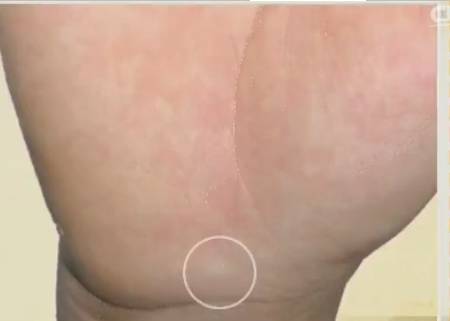 手的健康识别,手型看健康