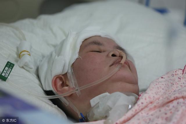 脑溢血后遗症康复热敷,脑溢血后遗症康复医院哪家比较好