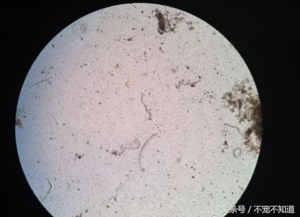 人感染犬钩虫怎么办,犬钩虫和蛔虫的区别