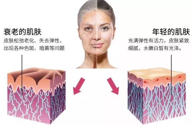 不打针就能有效去皱纹的产品,不用打针就能去皱的产品
