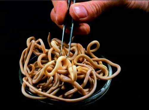 孕期感染蛔虫怎么办,孕期蛔虫病怎么办啊