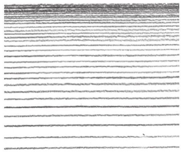 素描入门线条画法结构素描,素描排线怎么练两头轻中间重