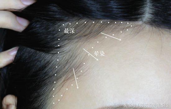 额头凸出有点像寿星公命运,额头饱满像寿星公好吗