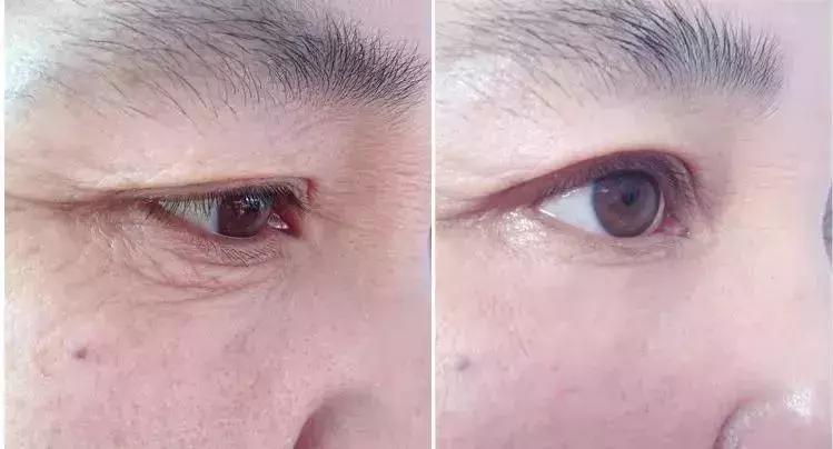 水乳二合一单品秋冬资生堂,资生堂口碑最好的抗老系列