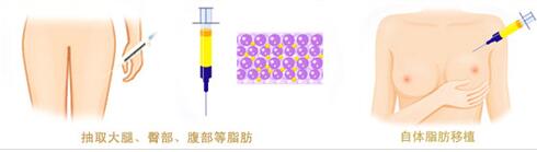如何拥有完美的胸型,怎么样才能有更好的胸部