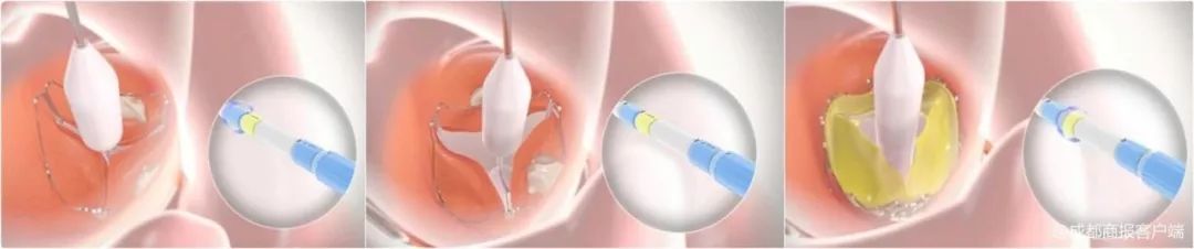 老人做心脏手术88岁,医生跪地给百岁老人做手术