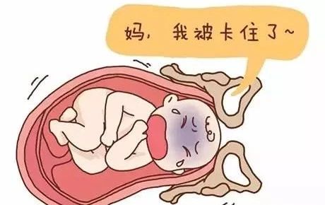 屁股大好生养是正确的吗,屁股大的女人好生养这说法靠谱吗
