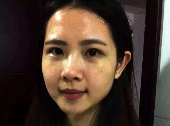 美白丸吃了真的可以美白吗,吃美白丸一般多久有效