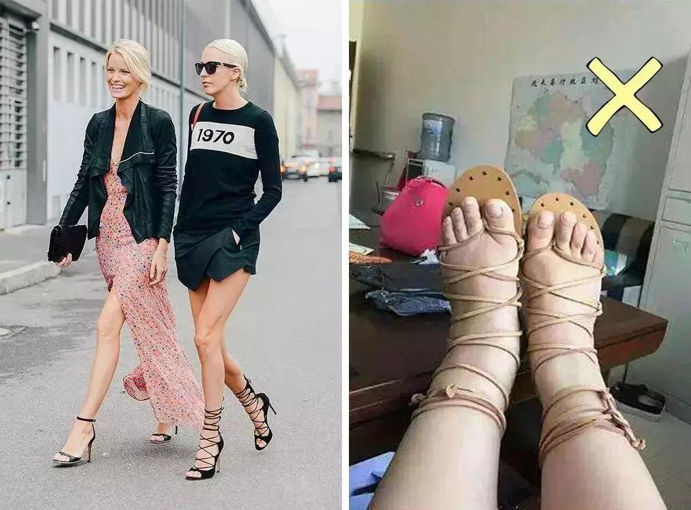 畸形脚型,看脚型分辨你适合穿怎样的鞋子