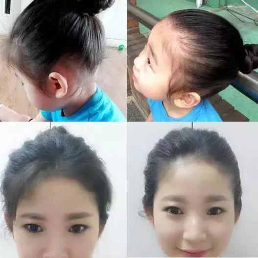 碎发多怎样才能让碎发变好看,超短碎发怎么补救女生