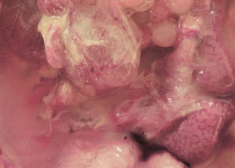 鹌鹑禽流感解剖图,鸡患禽流感症状及图片