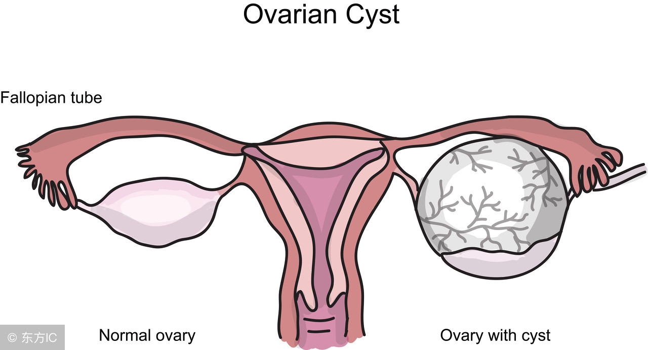 囊肿和肿瘤有什么区别？得了囊肿会危及生命吗？一次性全告诉你