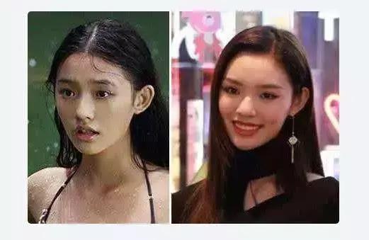 林允暴瘦照片,林允腿上的淤青原因