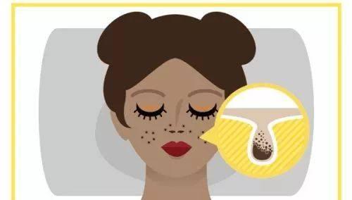 让毛孔变小最快的方法学生,让毛孔变小用什么药