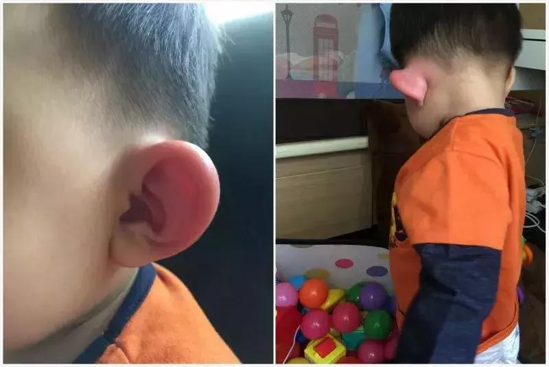 为什么青草膏的止痒效果那么好,儿童青草止痒膏