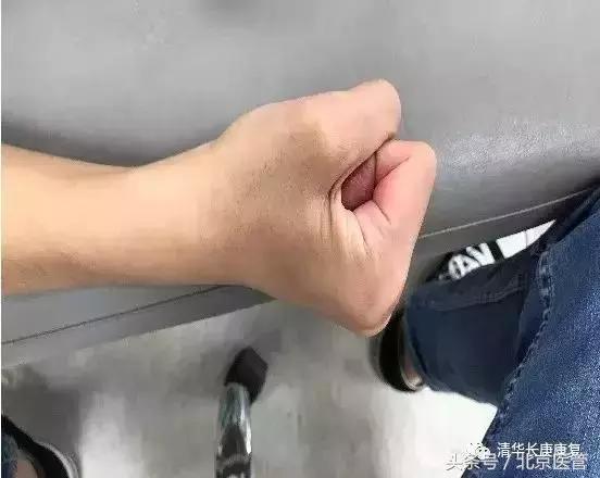 世界杯运动员损伤情况,世界杯球员受伤怎么处理