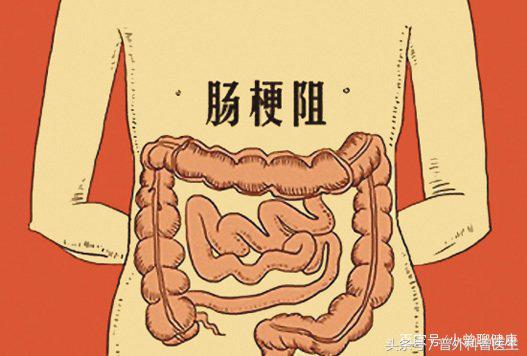 癌症晚期无法进食全身浮水,癌症晚期无法排便怎么回事