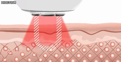 亲测好评家用美容仪推荐分享,美容仪十大排行榜亲测