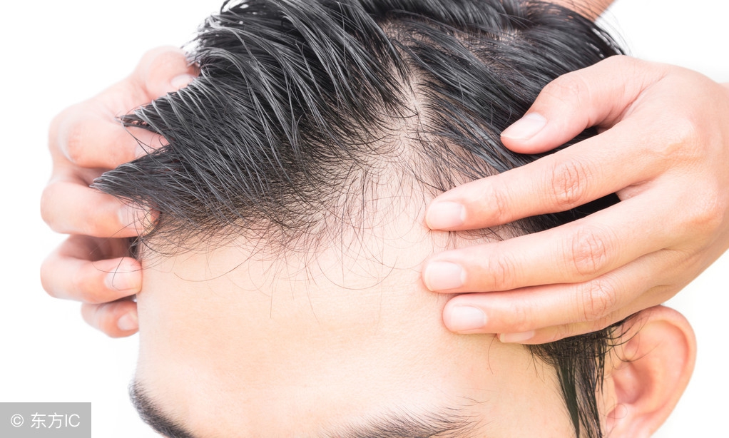 头皮上有螨虫用盐一招搞定,头皮痒除螨虫最快方法