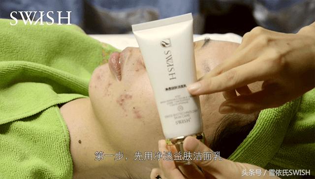 美容院排痘的流程图解，祛痘手法示范（含视频）