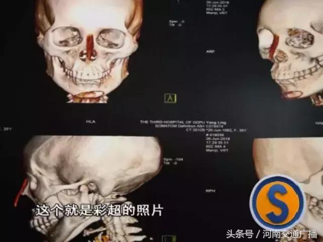 女子整容失败医院说没问题,女子整容失败医院讨说法被阻拦