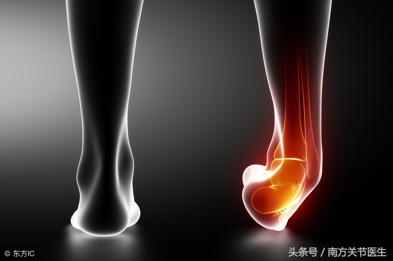 崴脚24小时后是冰敷还是热敷好,崴脚后什么时候冰敷什么时候热敷