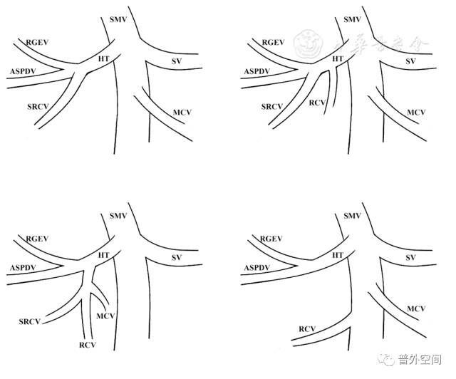 腹腔镜右半结肠癌手术步骤,腹腔镜右半结肠癌
