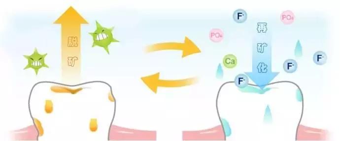 如何让你的蛀牙停止恶化三种方法,一招解决蛀牙的方法