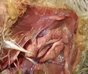 肾传支的最有效的治疗方法,肾传支是什么