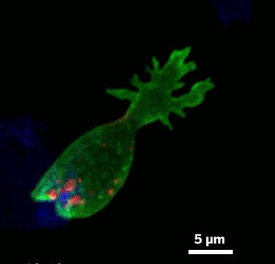 肿瘤细胞免疫治疗是什么,细胞免疫治疗视频大全