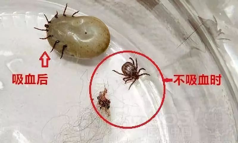 小心“新型艾滋病”，虫子就能传播