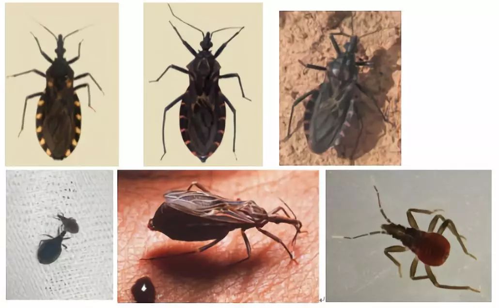 小心“新型艾滋病”，虫子就能传播