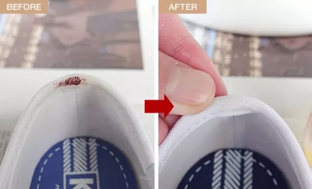 日本妇科病,日本女人妇科病少的原因