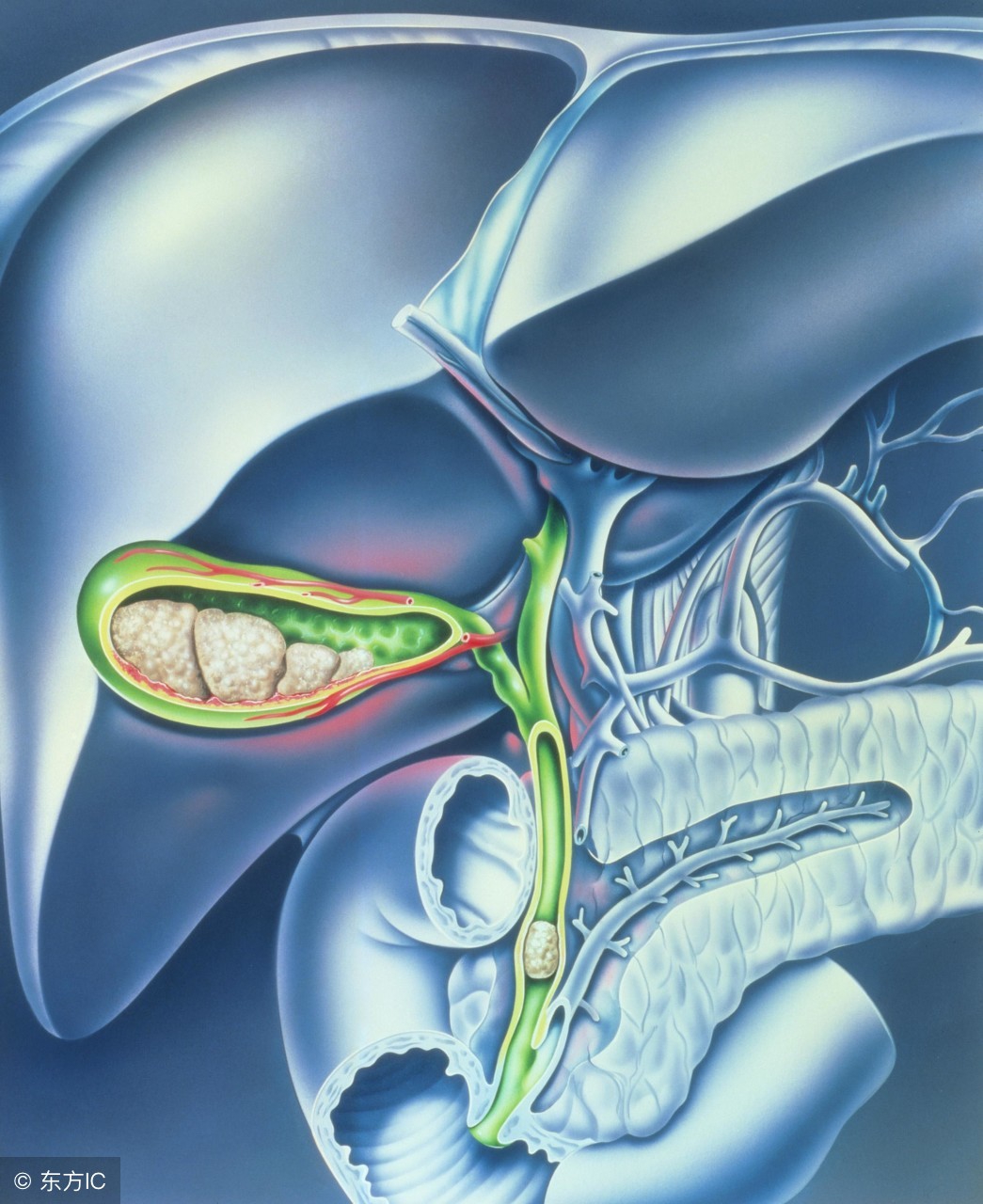 吃萝卜对胆结石有什么好处,胆结石吃什么蔬菜好处多