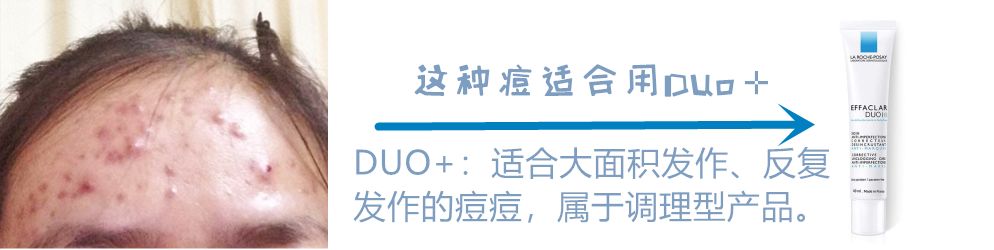 雅漾修护和理肤泉,药妆护肤品有哪些国货