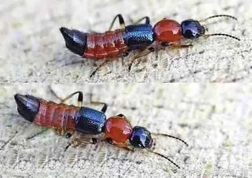 洗脸时碰了它，杭州女子差点毁容！最近高发，每个人都要当心