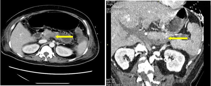 你有一线生机，我必万分努力｜规培医师ICU轮转纪实