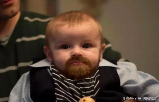 3岁女童来例假！全国有53万性早熟患儿，这些蛛丝马迹你要知道！