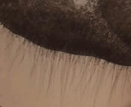 疼痛10大等级哪一级泪流满面,疼痛等级一百级分别都是什么