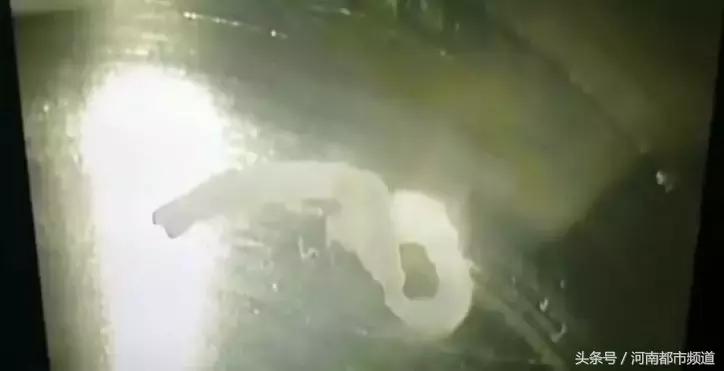 一女子发现眼睛看不清跑进寄生虫,一女子眼里藏条虫