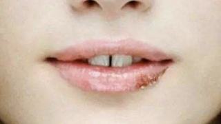 嘴上长泡了该如何解决,嘴上长泡了是什么原因