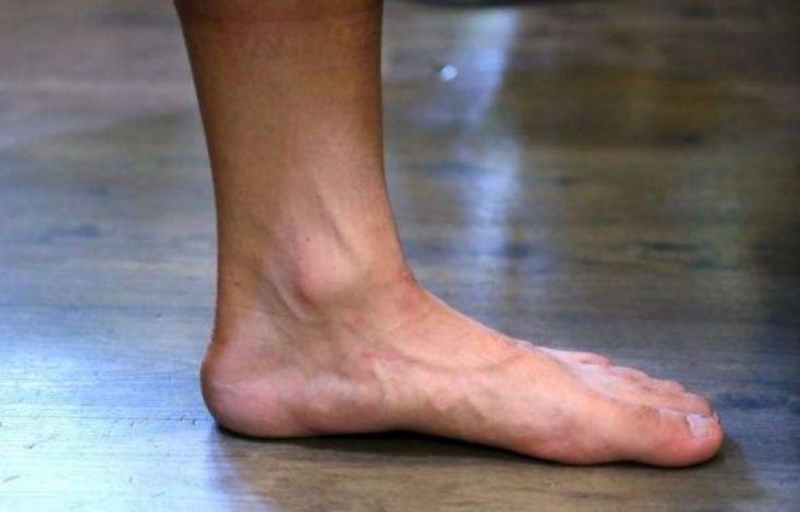 检查孩子脚部发育,怎么检查孩子的脚有没有问题