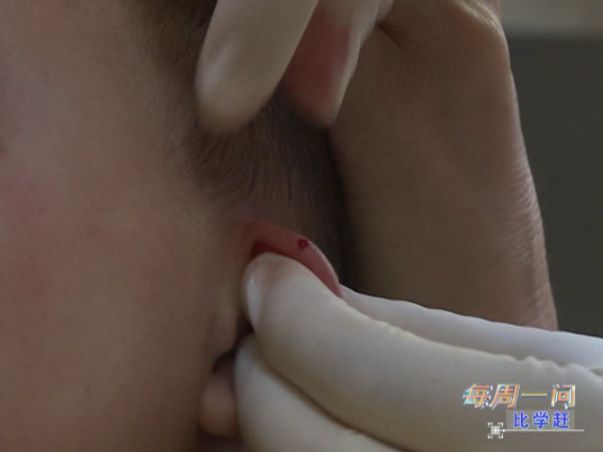 每周一问比学赶｜区卫计局：加强技术引进助力中医药事业发展