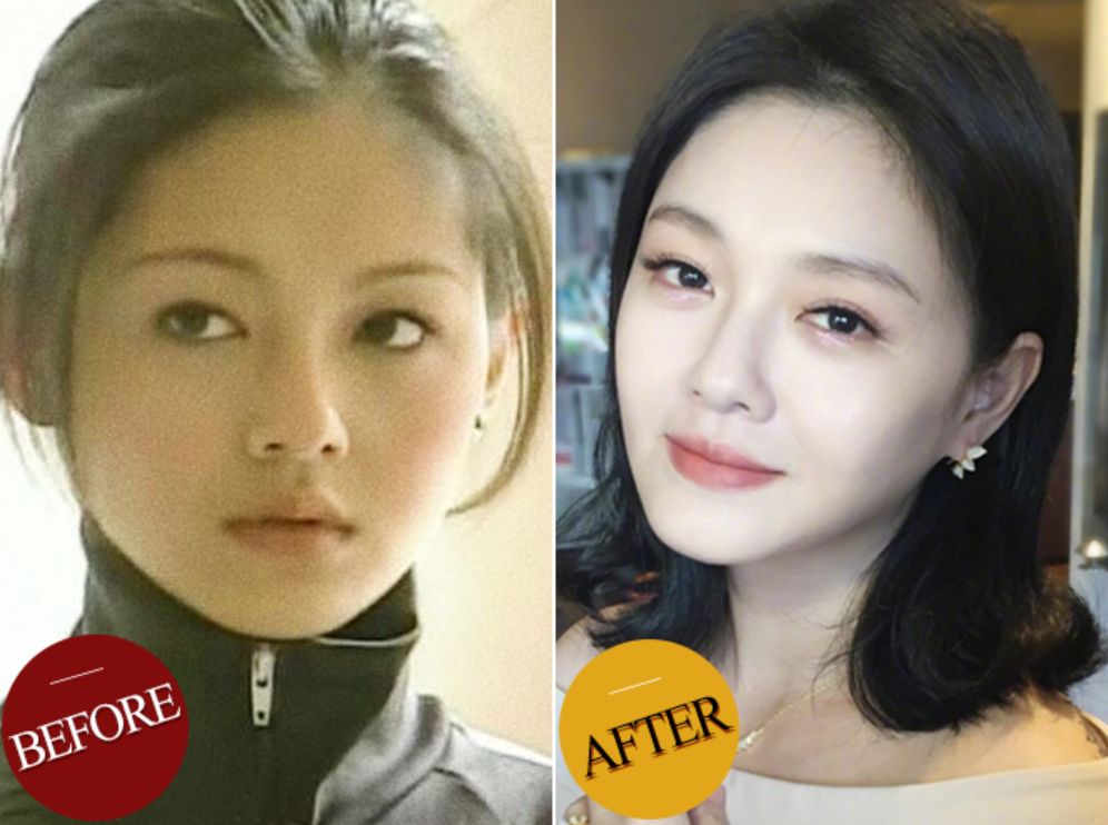 大s吃抗凝血剂谈话视频,大s抗凝血剂会让人变白吗