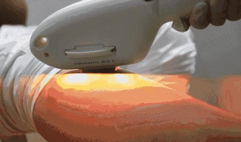 要想穿得少，脱毛要趁早！我用10款脱毛产品薅光了男同事的腿毛