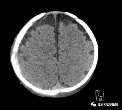 宝宝头部摔伤怎么办,小孩摔伤头部怎么办